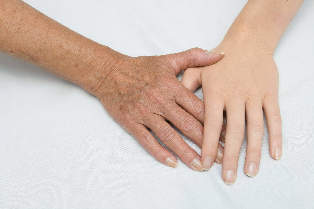подмладяване на кожата на ръцете