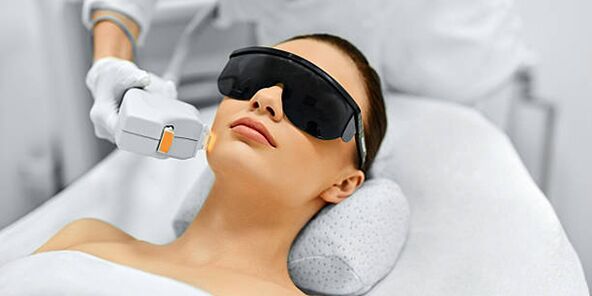 Лазерна процедура за подмладяване на кожата